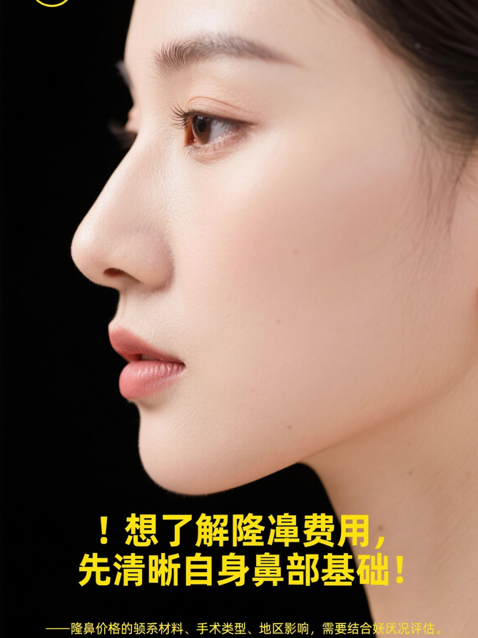 北京做玻尿酸隆鼻大概价格多少钱?玻尿酸隆鼻手术费用插图1 注意事项
