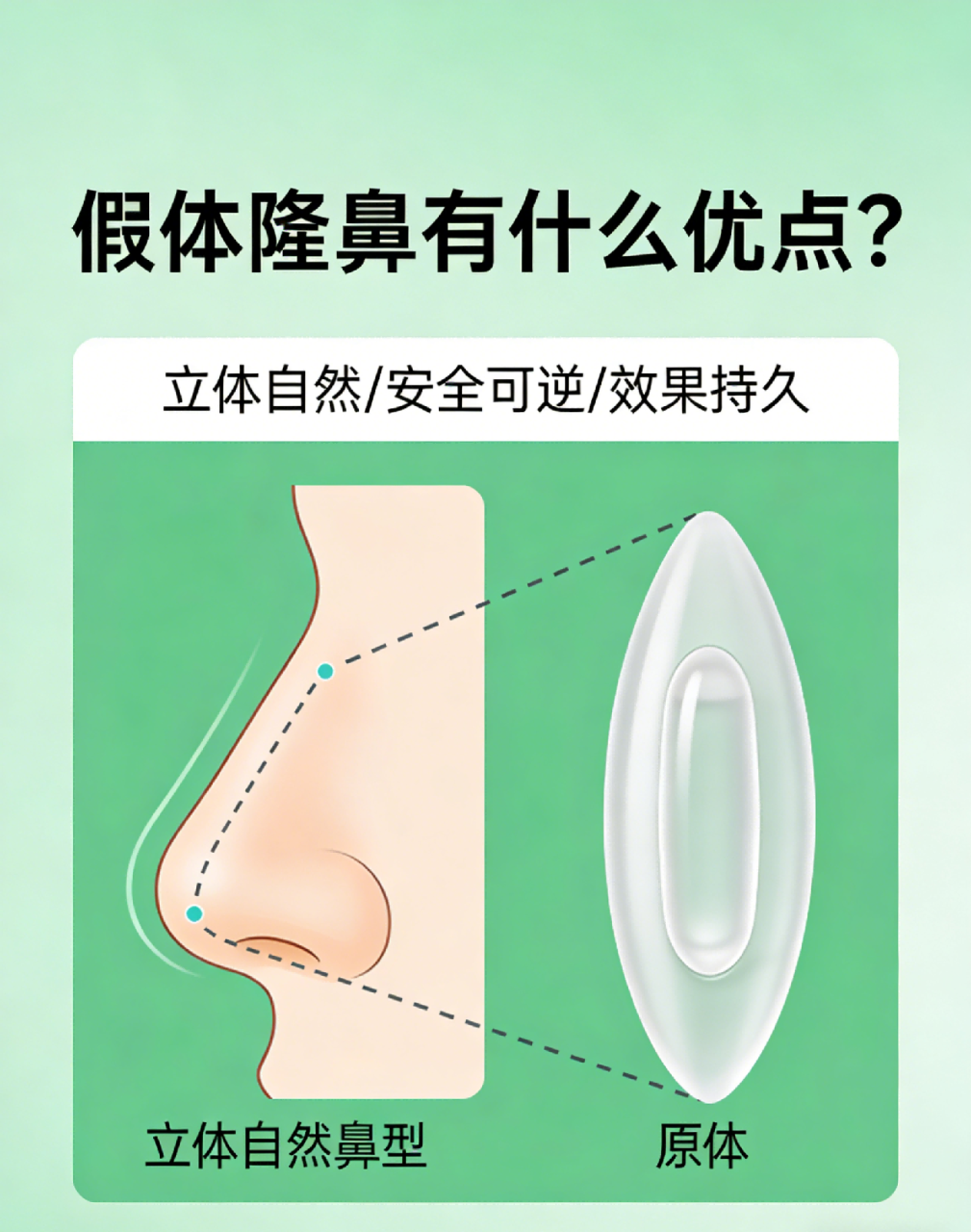 隆鼻假体可以保持多久?不同材料的隆鼻假体使用寿命及更换周期插图1 何时应该考虑更换假体?
