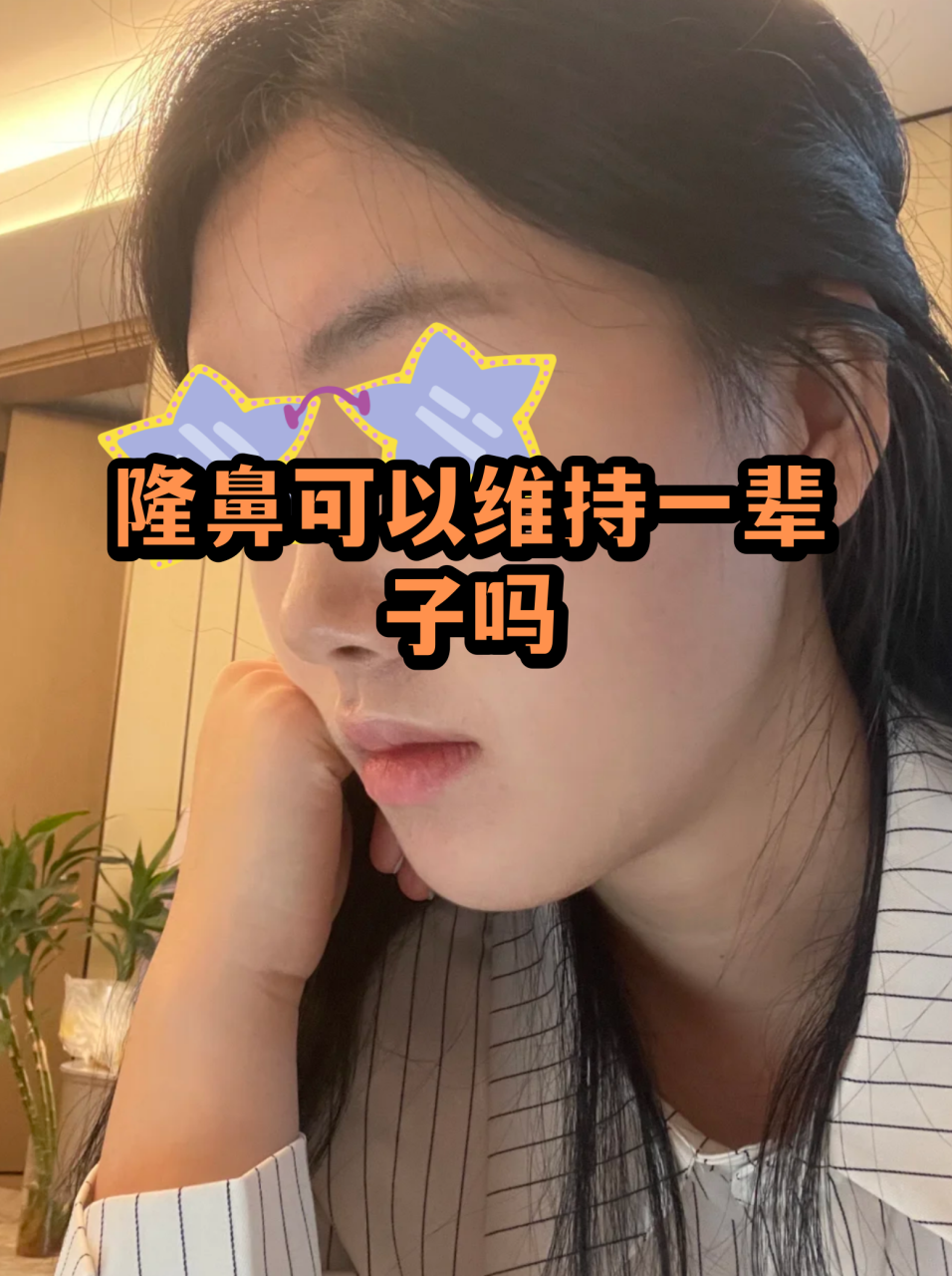 隆鼻假体可以保持多久?不同材料的隆鼻假体使用寿命及更换周期插图 不同材料假体的使用寿命
