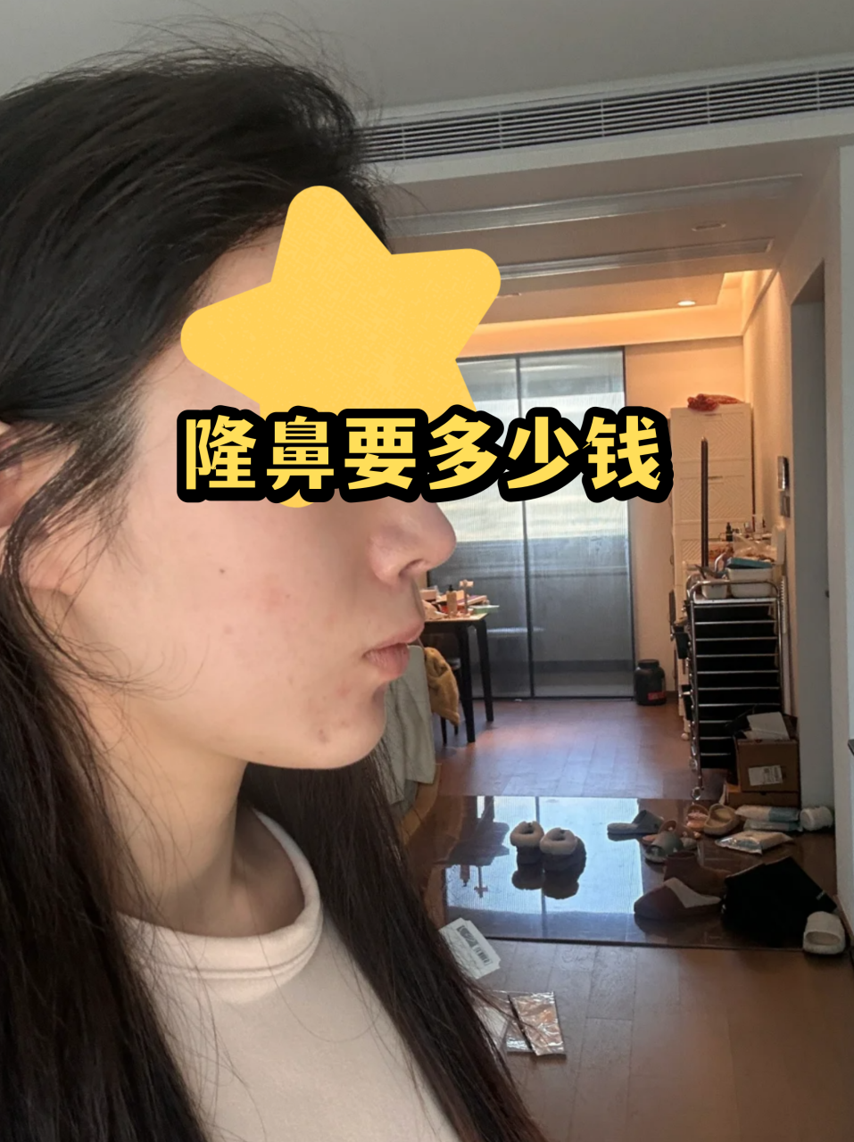 假体隆鼻价格分析 | 不同材质假体隆鼻手术费用对比插图1 有美严选的优势