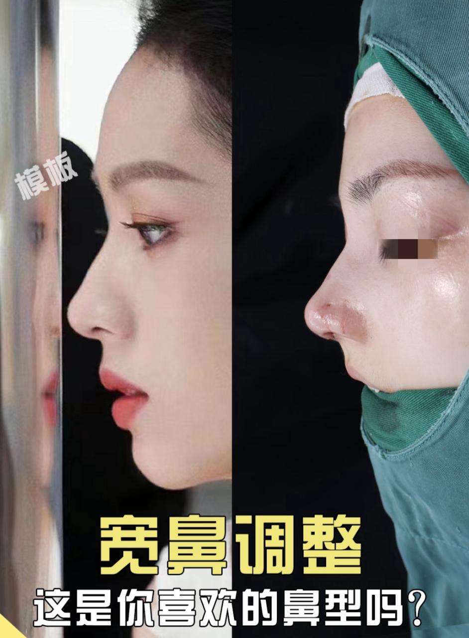 硅胶和膨体隆鼻哪个好?硅胶与膨体在隆鼻手术中的效果对比插图1 维护保养注意事项