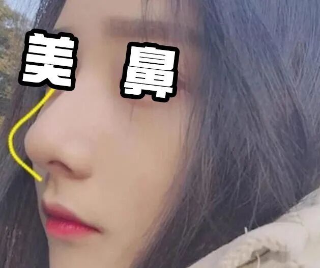 水滴鼻怎么整好?插图 图片