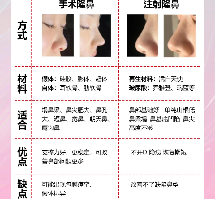 隆鼻误区有哪些?注射隆鼻和假体隆鼻哪种好?插图 图片