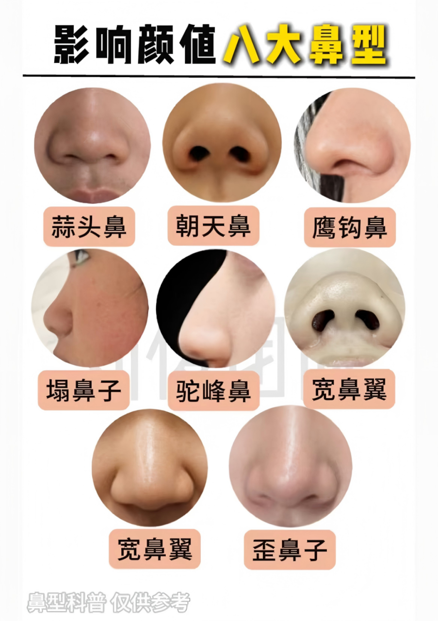 适合做隆鼻的鼻型?隆鼻术后的注意事项有哪些?插图 图片