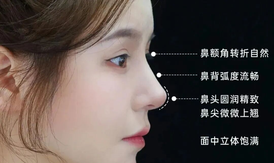 隆鼻术后鼻子肿胀淤血怎么办?隆鼻手术过程详解?插图 图片