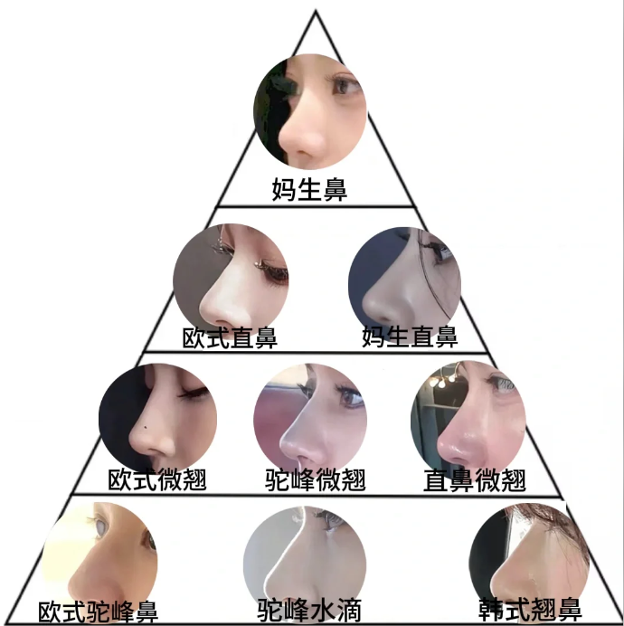 隆鼻哪种效果好?隆鼻后多久不会痛?插图 图片