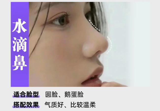 水滴鼻好吗?插图 图片