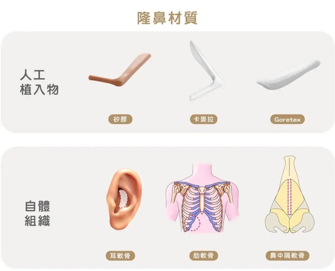 一般隆鼻用什么材料好?隆鼻子有哪些风险?插图 图片