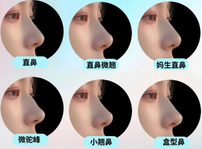 有问题的鼻型?隆鼻的鼻夹板可以自己拆吗?插图 图片