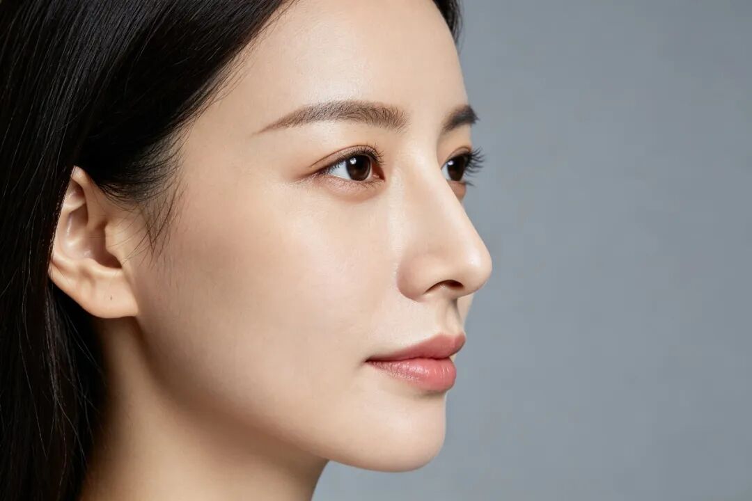 隆鼻后如何消肿?插图 图片