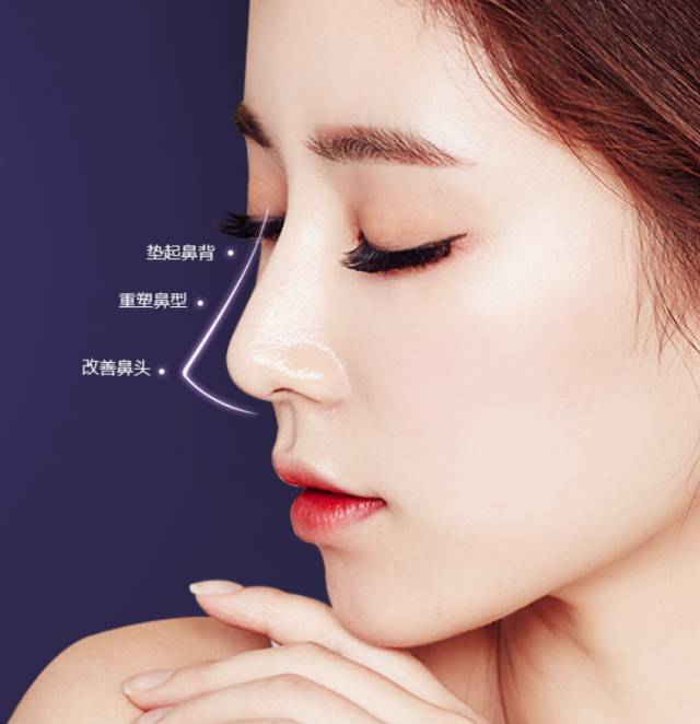 韩式无痕隆鼻手术的切口有哪些?韩式无痕隆鼻术前要做什么准备?插图 图片