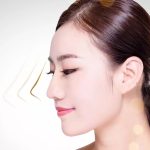 肋软骨鼻综合有哪些优缺点？