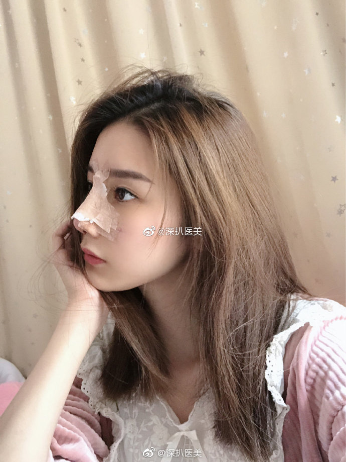 上海隆鼻哪家医院好？上海专业隆鼻手术推荐医院
