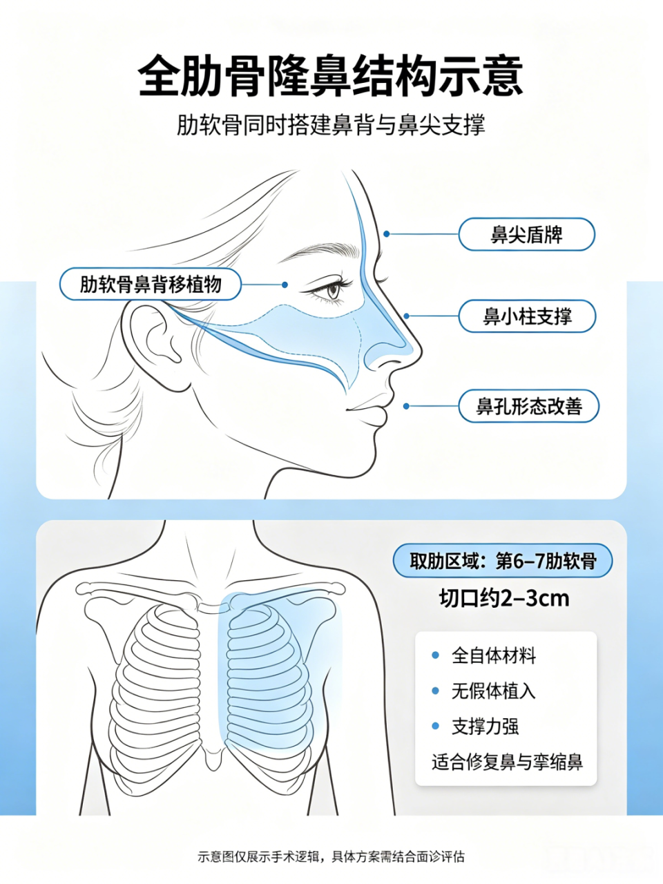 肋骨隆鼻疼吗？肋骨隆鼻取哪根肋骨？