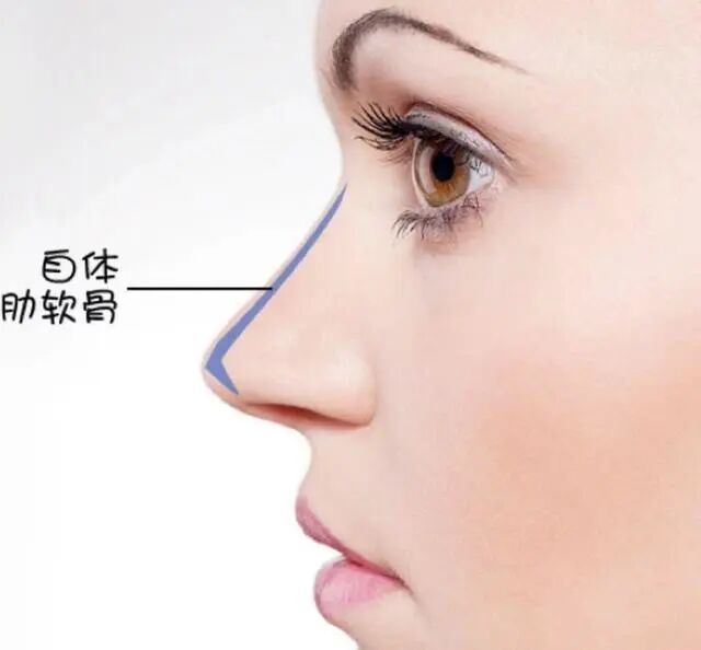 自体软骨垫鼻子费用一般多少钱啊